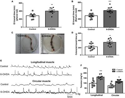 Enhanced Contractive Tension and Upregulated Muscarinic Receptor 2/3 in Colorectum Contribute to Constipation in 6-Hydroxydopamine-Induced Parkinson’s Disease Rats